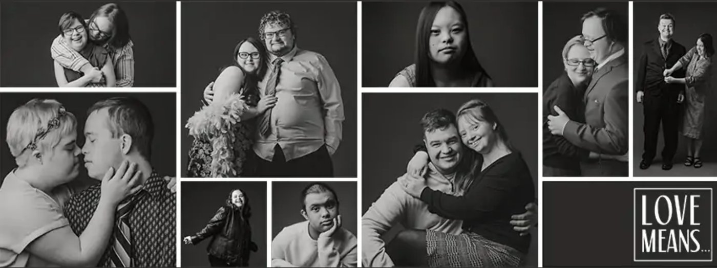 Confronting Perceptions By Showing Love With Down Syndrome