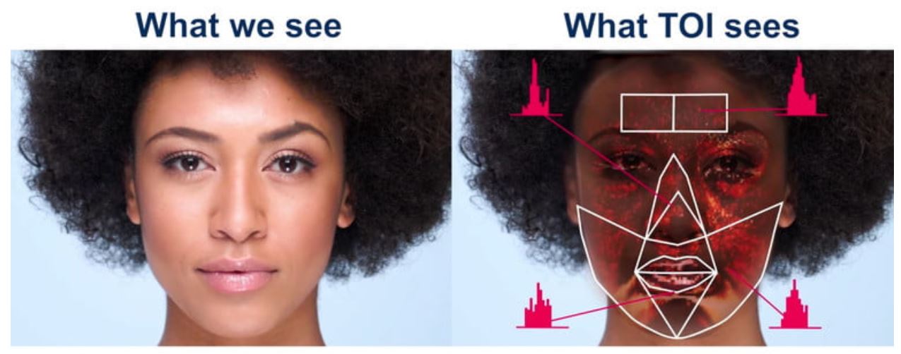 Why Your Next Health Screening Might Happen Via Selfie