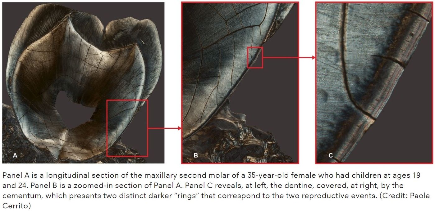 Like Tree Rings, Your "Tooth Rings" May Tell Your Life Story
